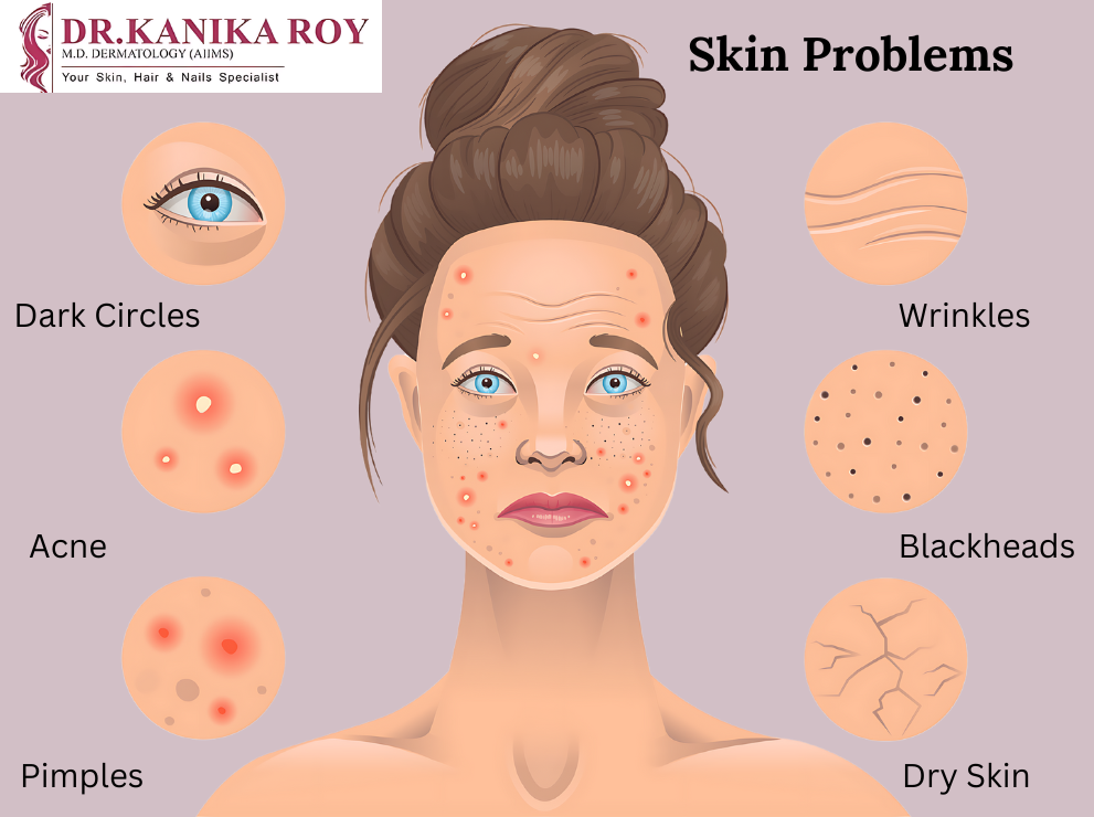 Skin Problems