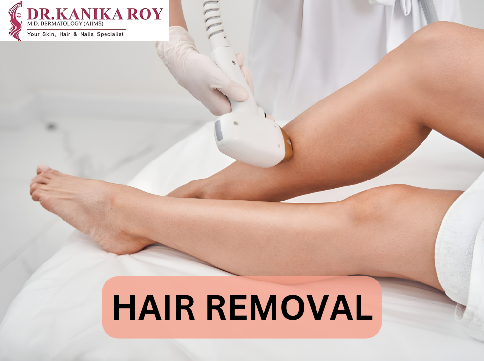 Hair Removal